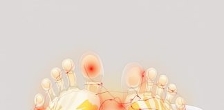 découvrez les effets secondaires courants des semelles orthopédiques et les solutions efficaces pour les atténuer, afin d'améliorer votre confort et votre santé.